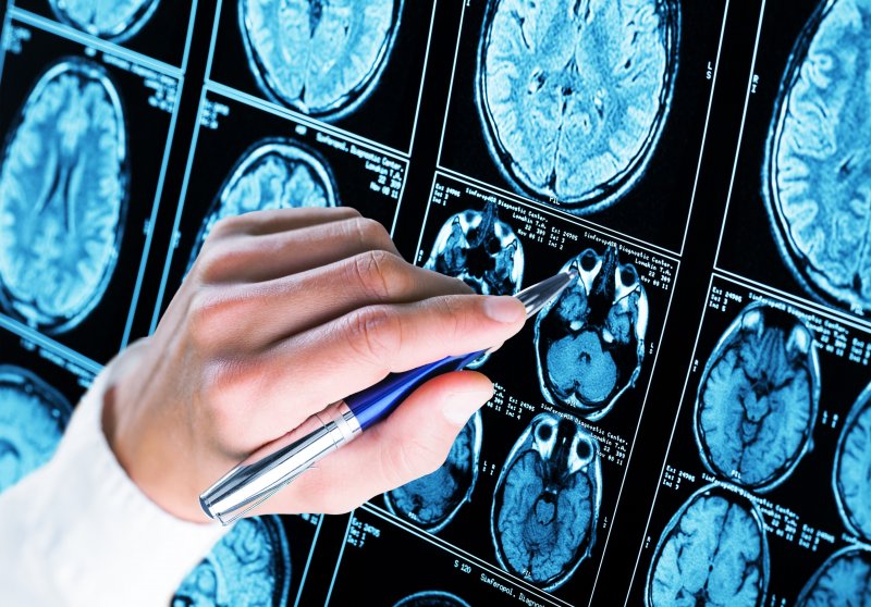 doctor marking a brain scan  