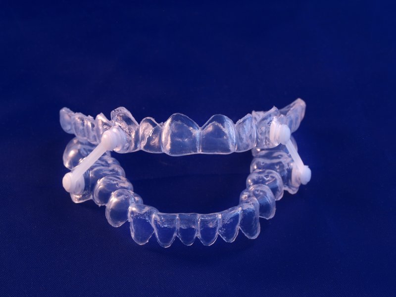 sleep apnea oral appliance 