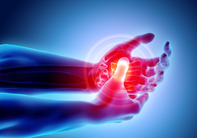 Digital illustration of rheumatoid arthritis